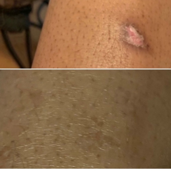 Moisturizes skin reduces dark spots improves skin elasticity - Picture 8 of 9